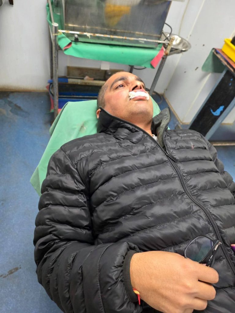 हरिद्वार बाईपास रोड पर पत्रकार हेम भट्ट पर तीन गुंडों ने किया हमला