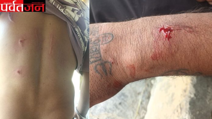 Chamoli leopard attack,