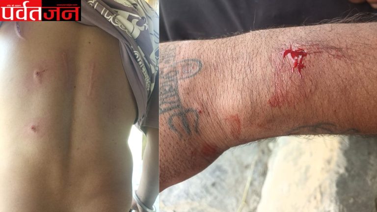 Chamoli leopard attack,