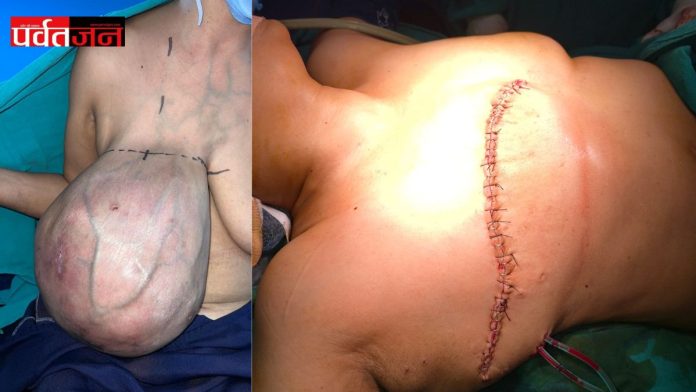 Breast Tumor Surgery